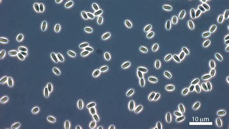 Mikrosporidia: Mikroskooppinen loisäänipossu, joka voi piiloutua melkein mihin tahansa!