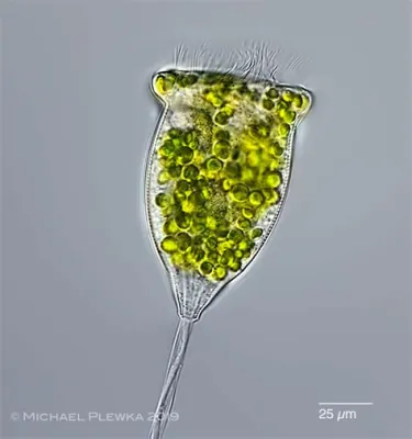  Vorticella! A Tiny Whirlwind of Freshwater Life With Microscopic Tentacles That Capture Food